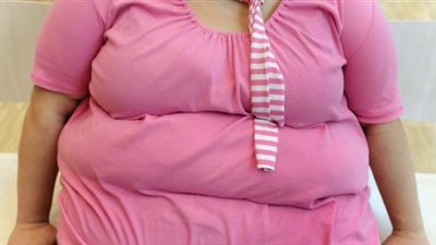 دراسة تكشف العلاقة بين الذاكرة ومرض السمنة