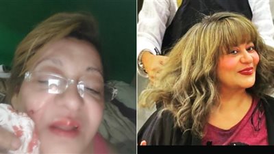 إصابة فريدة سيف النصر في وجهها بسبب الحسد (صور)