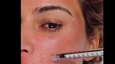 هل تسبب الخلايا الجذعية ضررًا أكثر من نفعها؟