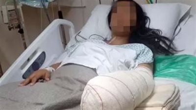 عاونه مدرس تربية رياضية.. طبيب يقضي على مستقبل سيدة بعملية تجميل فاشلة
