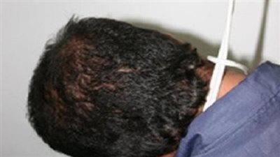  لمروره بأزمة نفسية.. تفاصيل تخلص شاب من حياته في الدقهلية