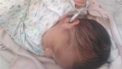 الصحة: فحص 4 ملايين و997 الف طفل ضمن مبادرة الكشف المبكر وعلاج ضعف وفقدان السمع