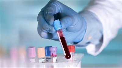 اختبار دم بسيط يمكن أن يكشف عن 50 نوع من السرطان