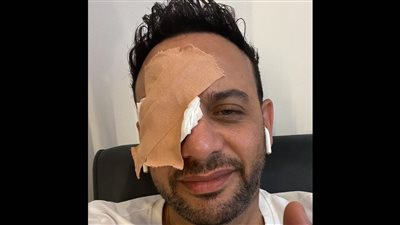 بعد إصابته في عينه.. مصطفى قمر: منك لله يا خالد يا سرحان (صورة)