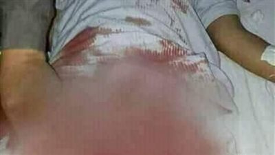 تطورات مثيرة فى واقعة سيدة المطرية المتهمة ببتر العضو الذكرى لعشيقها