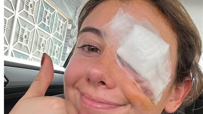 ترند جديد على التيك توك يؤدي بامرأة إلى جراحة في العين