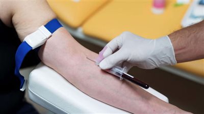 في اليوم العالمي لمرض التهاب الكبد الوبائي.. تعرف على أكثر درجاته خطورة!