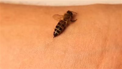 كيف تتعامل مع لدغات النحل؟ وما العلاجات المنزلية؟