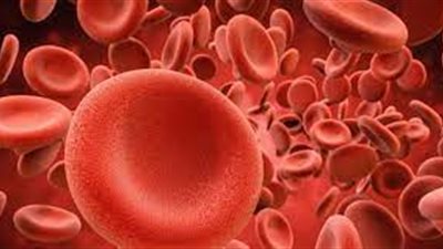 ربع سكان العالم يعانون من فقر الدم