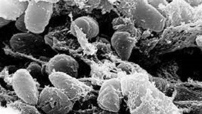 الطاعون الدبلي.. القصة الكاملة لـ الموت الأسود