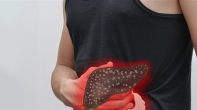 تعرف على الأعراض الأولية للإصابة بأمراض الكبد