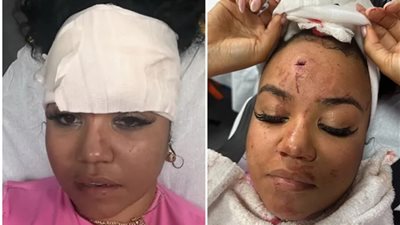 مطرب شهير يتسبب في إصابة مذيعة (فيديو وصور)