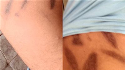 شاب من أسوان يحكي مأساته على يد «السريع وأبو زلال»: عذبونى وصورنى 