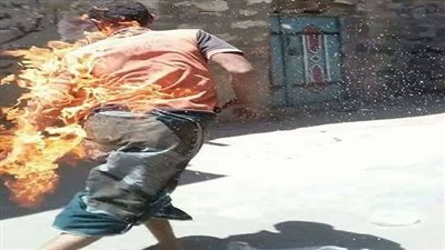 «موقد بلدي» يتسبب في كارثة احتراق شاب داخل منزله بسوهاج