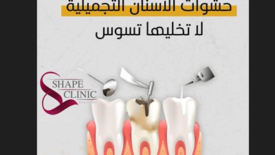 لا تخليها تسوس.. مبادرة مستوصف شيب كلينك لحشوات الأسنان التجميلية