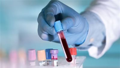 8 إجراءات بسيطة تساهم في مكافحة الشيخوخة