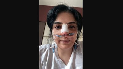 أصعب وجع.. أول ظهور لـ حورية فرغلي بعد إجراء عملية جراحية في أنفها