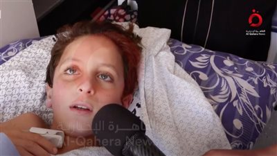 بعد توجيه الرئيس بعلاجه.. طفل فلسطيني: 