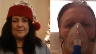 حالة طبية نادرة.. امرأة تعاني من حساسية قاتلة من رائحة عيد الميلاد