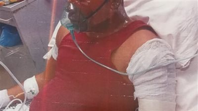 «مكالمة هاتفية» وراء تورط شقيقان في إشعال النيران بجسد جارهما في الإسكندرية