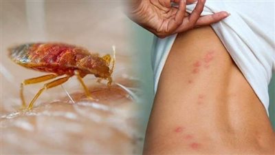 مخاوف من انتشار حشرة البق داخل مدرسة لغات بالقاهرة وتحولها لوباء 