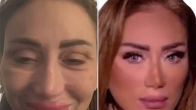 طبيب التجميل يهاجم ريهام سعيد وينشر فيديوهات ترهل بشرتها قبل وبعد العملية