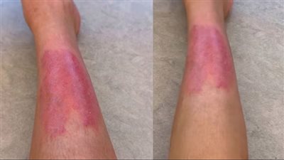 كيم كارداشيان تكشف عن مرض مرعب ينتشر في جسمها