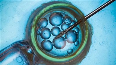 تحذيرات من انخفاض الخصوبة لدى النساء بالمستقبل القريب