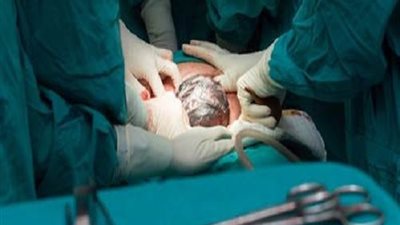 التحقيقات تكشف كوارث لـ«دكتور نساء» في عمليات الولادة القيصرية بأسيوط