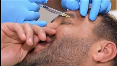 بالصور.. رامي صبري يخضع للحقن بوجهة داخل مركز تجميل نادر صعب بدبي
