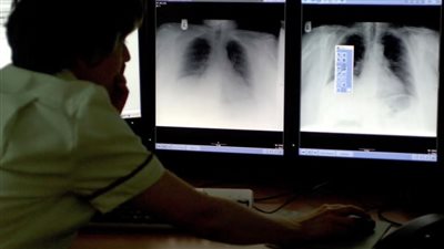 أطباء يحذرون من استخدام الذكاء الاصطناعي في مجال الأشعة الطبية