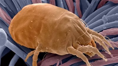 تقرير علمي: الغبار المخفي في منزلك يمكن أن يصيبك بمرض خطير