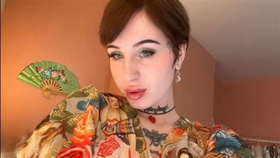 ما هي متلازمة بولندا التي تعاني منها بعض النساء؟