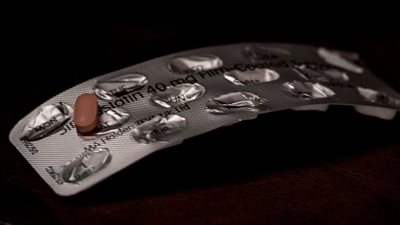 كيف تساعد أدوية الكوليسترول في علاج اللثة؟