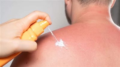 هل يتم إنتاج أول لقاح لعلاج سرطان الجلد؟ 