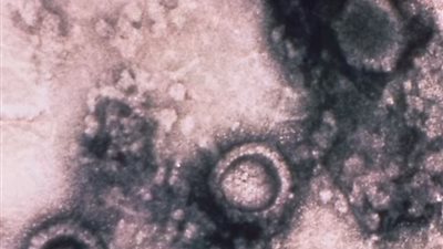 تجربة خطيرة.. علماء يكتشفون فيروس الهربس القديم ويريدون إعادته للحياة 