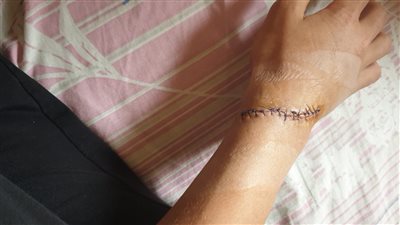 طالب يعتدى على زميله بـ«كتر» أمام باب المدرسة.. والأم: «عاوزة حق ابنى»