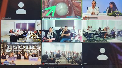 خلال مؤتمر المصرية لزرع العدسات.. نقل مباشر لإجراء العمليات الجراحية لـ3 دول إفريقية