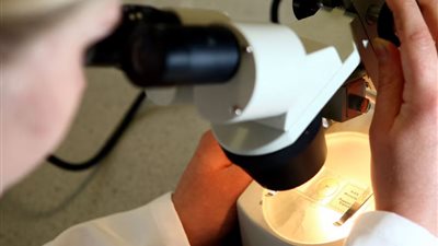 أبحاث جديدة تكشف عن أداة جديدة لفحص سرطان البروستاتا