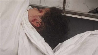 الكلاب الجبلية تهاجم المدينة وتقتل طفل وتصيب 4 اخرين في 15 مايو