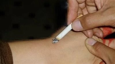 أب يعذب أبنائه بإطفاء السجائر فى جسدهما بالسلام.. إعترافات تفصيلية