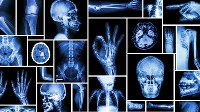  هيئة الدواء توضح تعليمات مهمة للمريض قبل إجراء الأشعة السينية