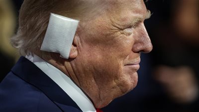 نائبه يتراجع عن تصريح نساء القطط..ترامب يفند مزاعم التشكيك في الرصاصة التي أصابت أذنه 