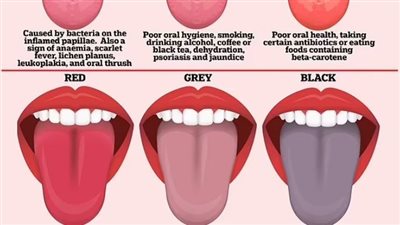 معادلة خوارزمية تشخص مرض السكري بفحص هذا العضو
