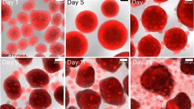 لأول مرة.. علماء ينجحون في زراعة خلايا الدم الجذعية في المختبر
