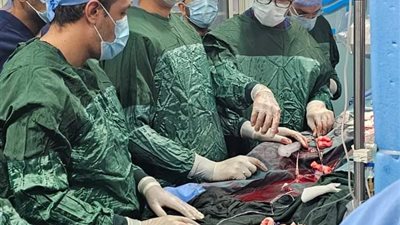 معهد القلب ينجح في إجراء قسطرة معقدة بجهاز الإيكمو