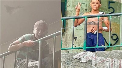  جريح ناجي من مجزرة جيش الاحتلال يتحدى إسرائيل بشارة النصر