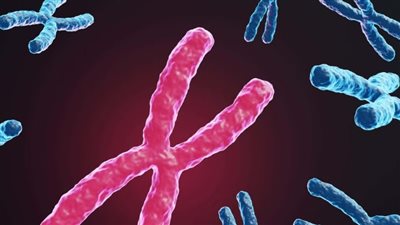 ما هي متلازمة إكس الذي تؤدي لصعوبات التعلم عند الأطفال؟