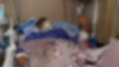 التقرير الطبي لضحية الاعتداء بحلوان: 4 أشخاص تسببوا في كسر جمجمته