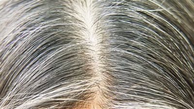 علامات في جسمك تشير إلى نقص الحديد